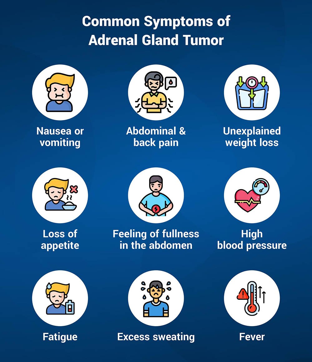 Everything You Need to Know About Adrenal Gland Tumor 2