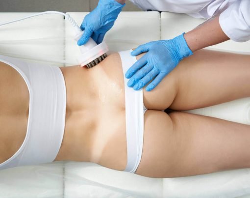 Achieve Your Ideal Figure with Ultrashape Hong Kong