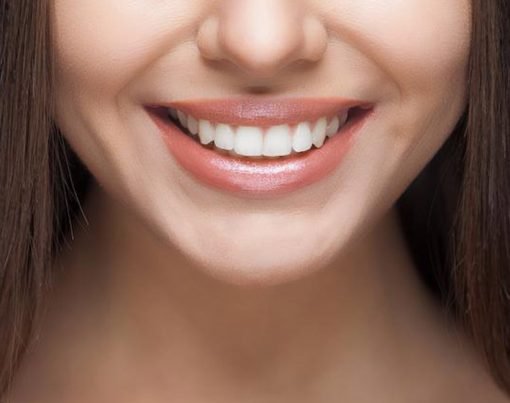 Common Appearance Problems Veneers Can Treat