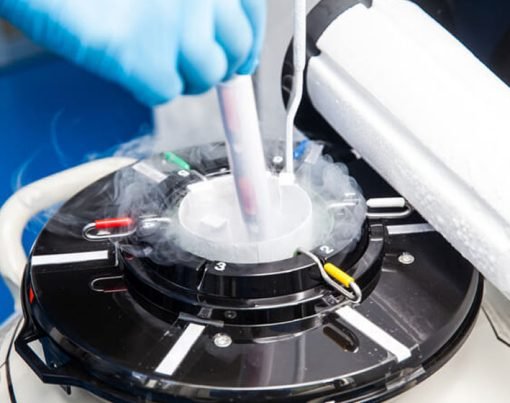 How to Ship Embryos or Gametes to Another Clinic