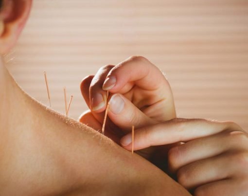 How to Treat Depression With Acupuncture and Counselling