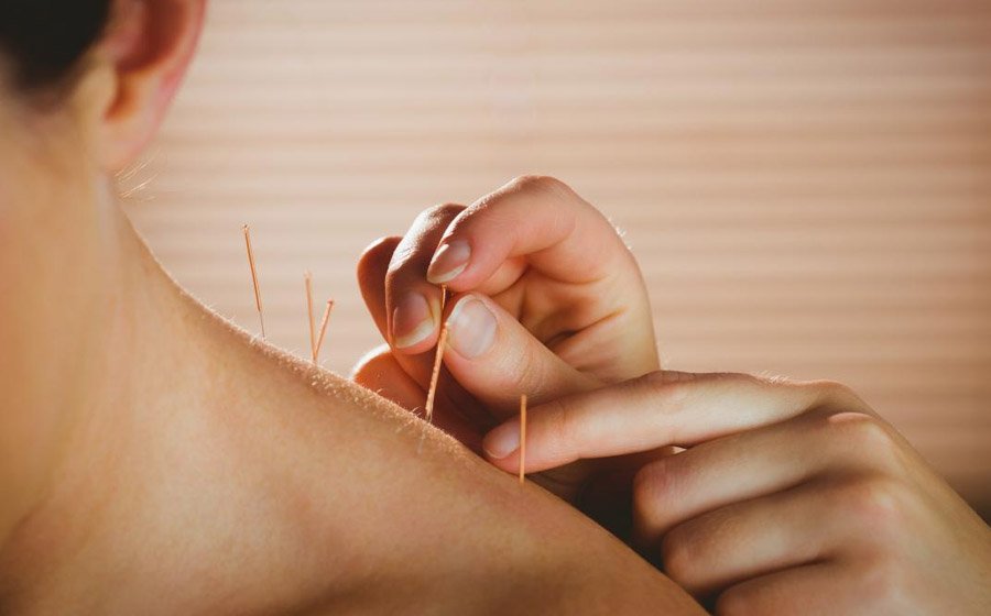 How to Treat Depression With Acupuncture and Counselling