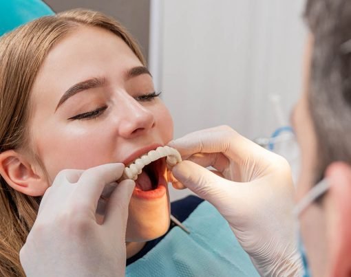 doctor tries on a denture