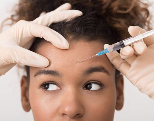 Understanding How Often to Get Botox for Optimal Results