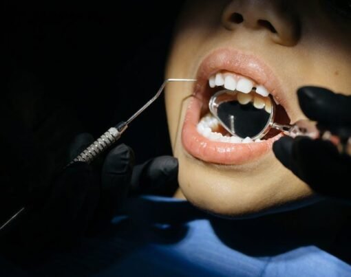 Recognizing Wisdom Tooth Infection Symptoms