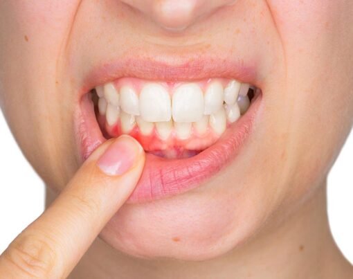 Painless Gum Grafting Procedures