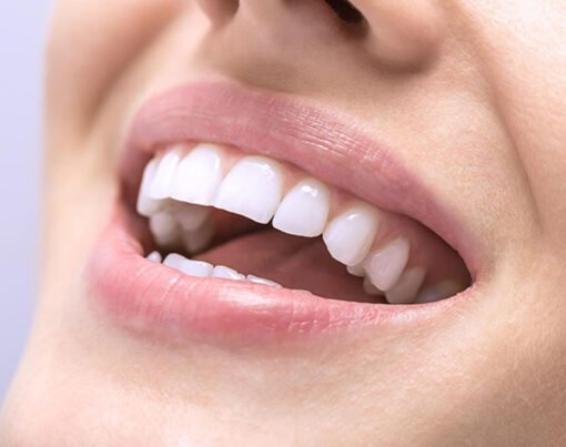Insider Tips for Whiter Teeth
