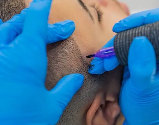 Innovative Treatments for Hair Loss