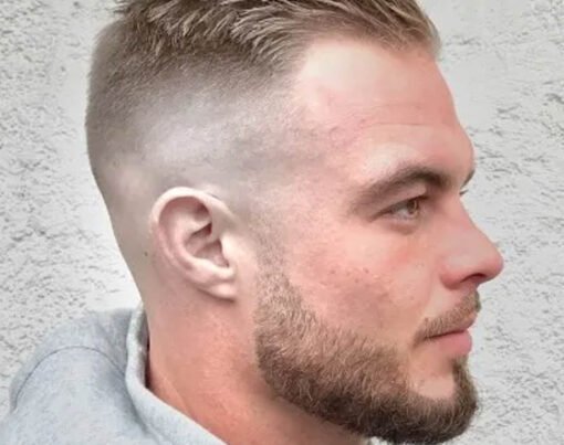 Best Hairstyles for Male Pattern Baldness