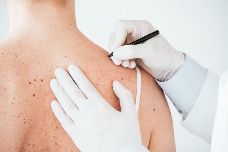 Top-Rated Skin Cancer Clinic in Melbourne: Expert Diagnosis & Treatment ...