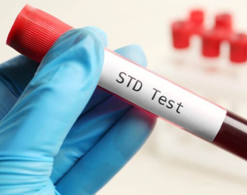 Navigating STD Tests