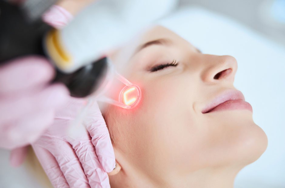 CO2 Laser Resurfacing vs. Other Skin Treatments