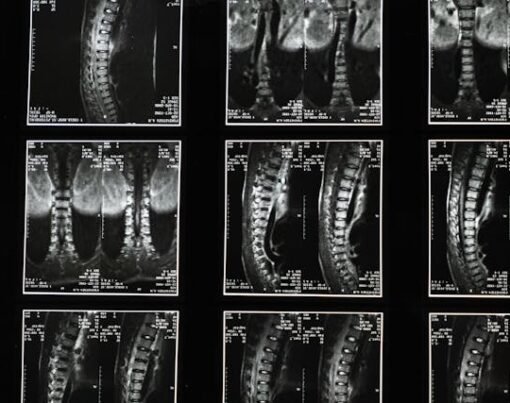 Path to Pain Relief Navigating the World of Spine Surgery